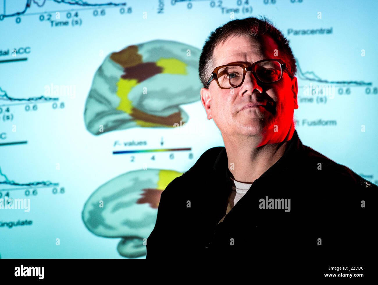 Navy Cmdr. John Hughes, director of the Magnetoencephalography (MEG) Laboratory at the National Intrepid Center of Excellence (NICoE) at Walter Reed National Military Medical Center in Bethesda, Md., stands before an image of magnetic fields generated by the brain, March 16, 2017. Unlike its cousin, the more commonly used electroencephalography (EEG), the MEG brain scan can see changes in structures that reside deep in the brain tissue. By measuring minute changes in magnetic fields generated by the cerebral cortex while resting, while thinking and while engaged in some particular task, defici Stock Photo