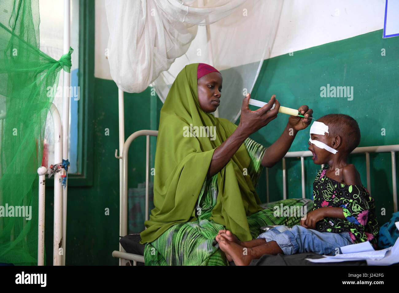 A Somalia women feeds her malnourished child fitted with a nasogastric tube inside a ward dedicated for diarrhea patients at the Banadir hospital March 9, 2017 in Mogadishu, Somalia. Somalia is experiencing a severe drought, and may be on the brink of famine unless urgent humanitarian action is taken soon. Stock Photo