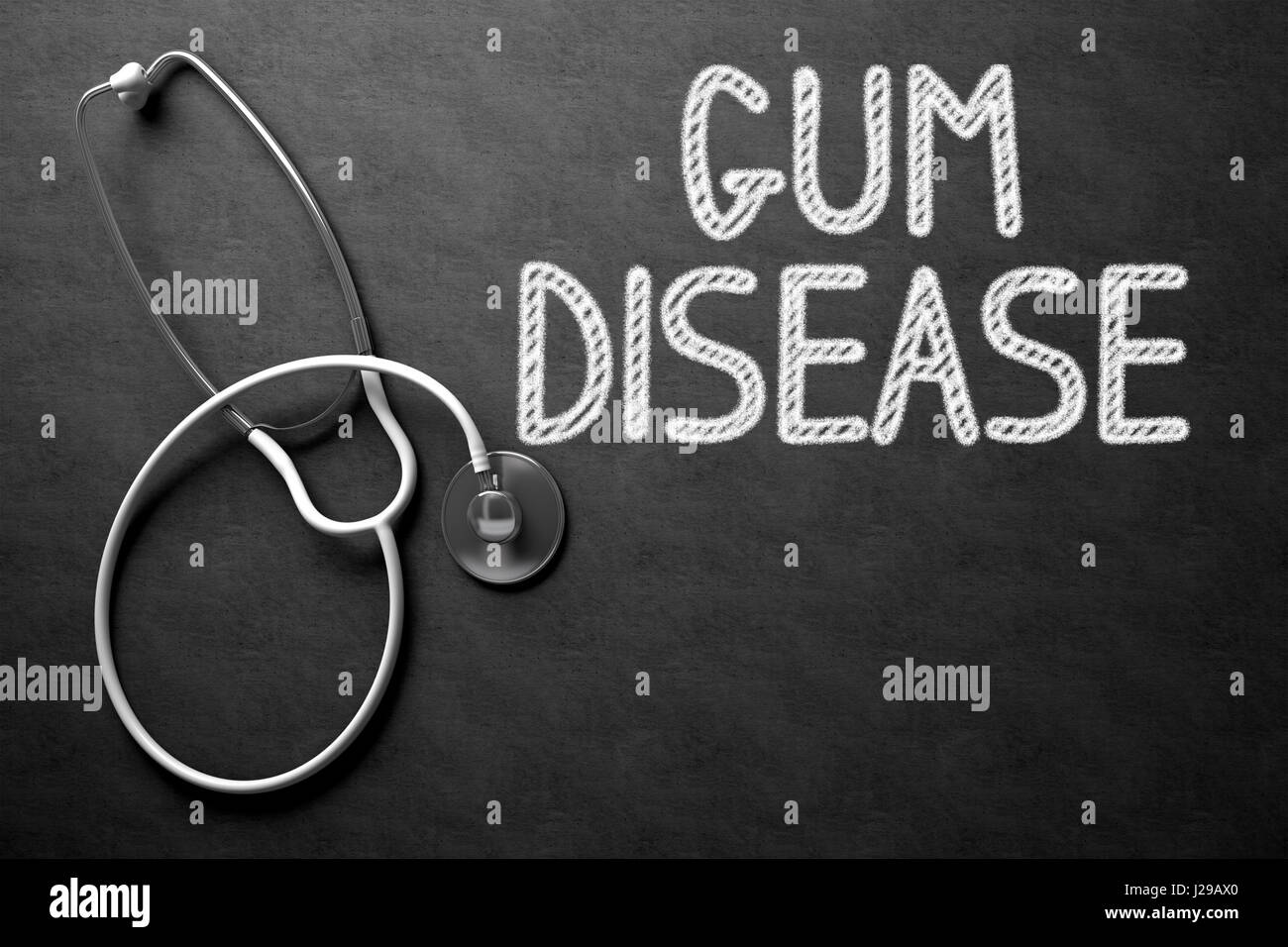 Gum Disease - Text on Chalkboard. 3D Illustration. Stock Photo