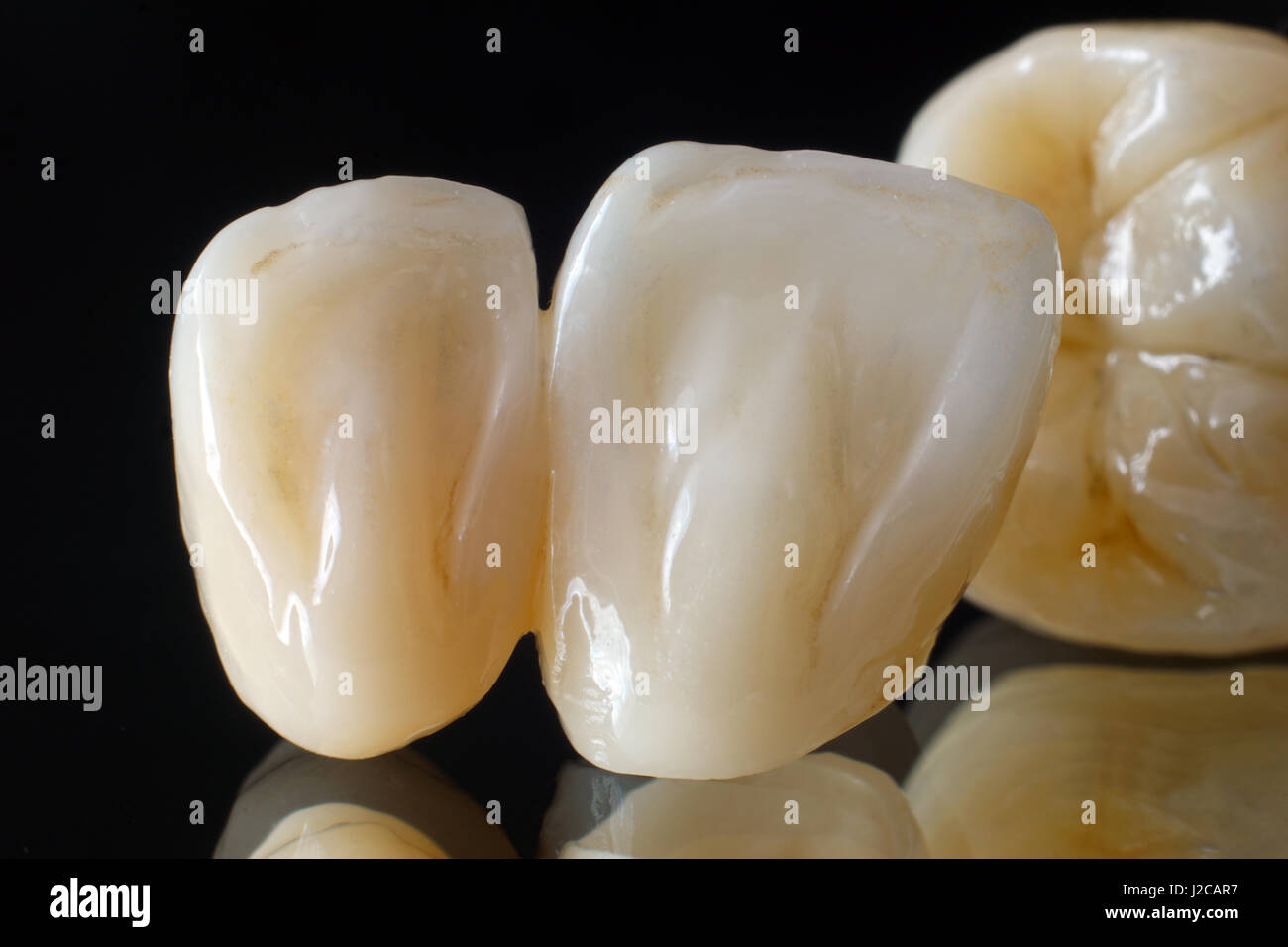Ceramic zirconia teeth Stock Photo Alamy