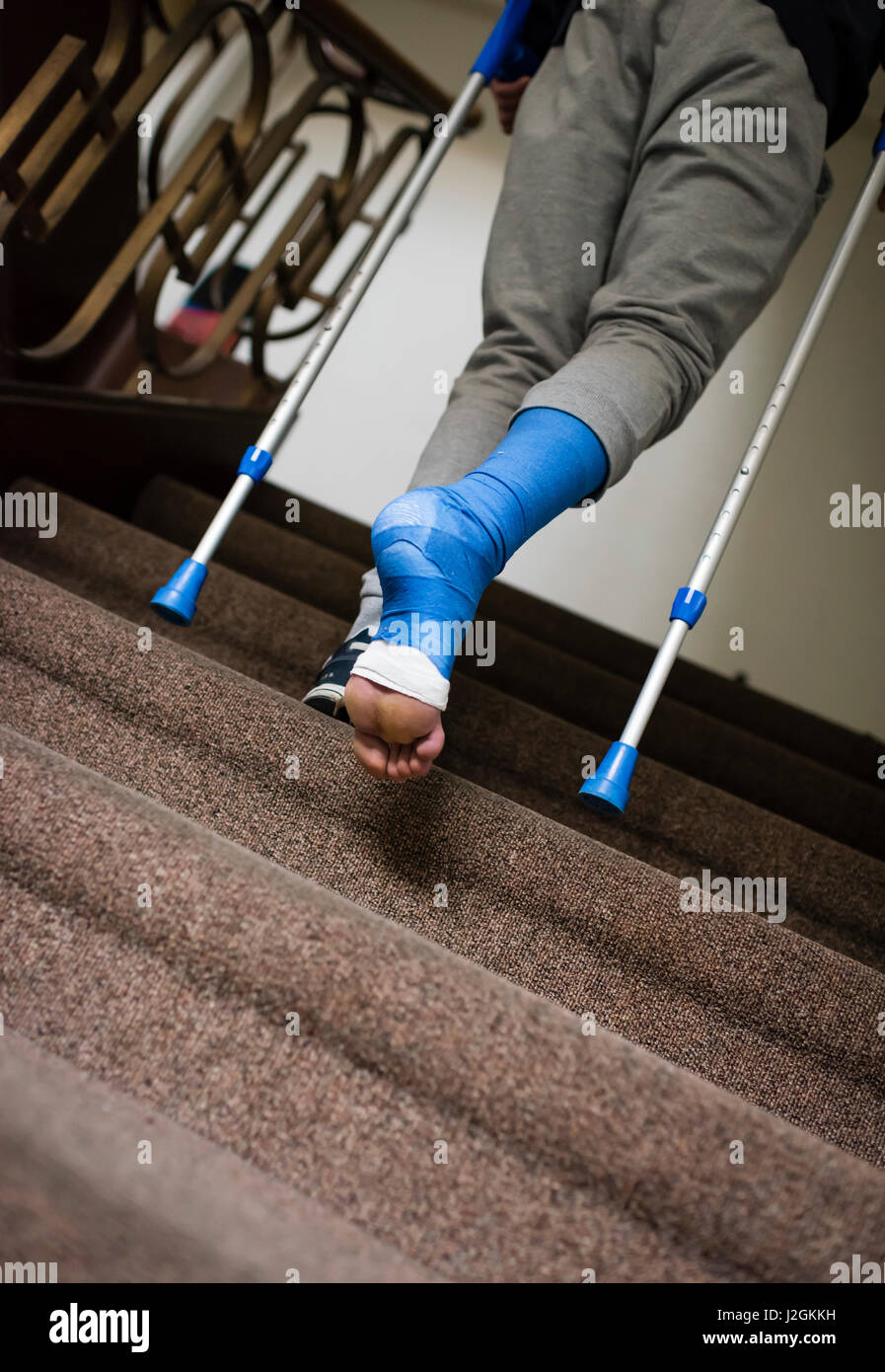 A young adult with crutches and his foot bandaged in plaster is