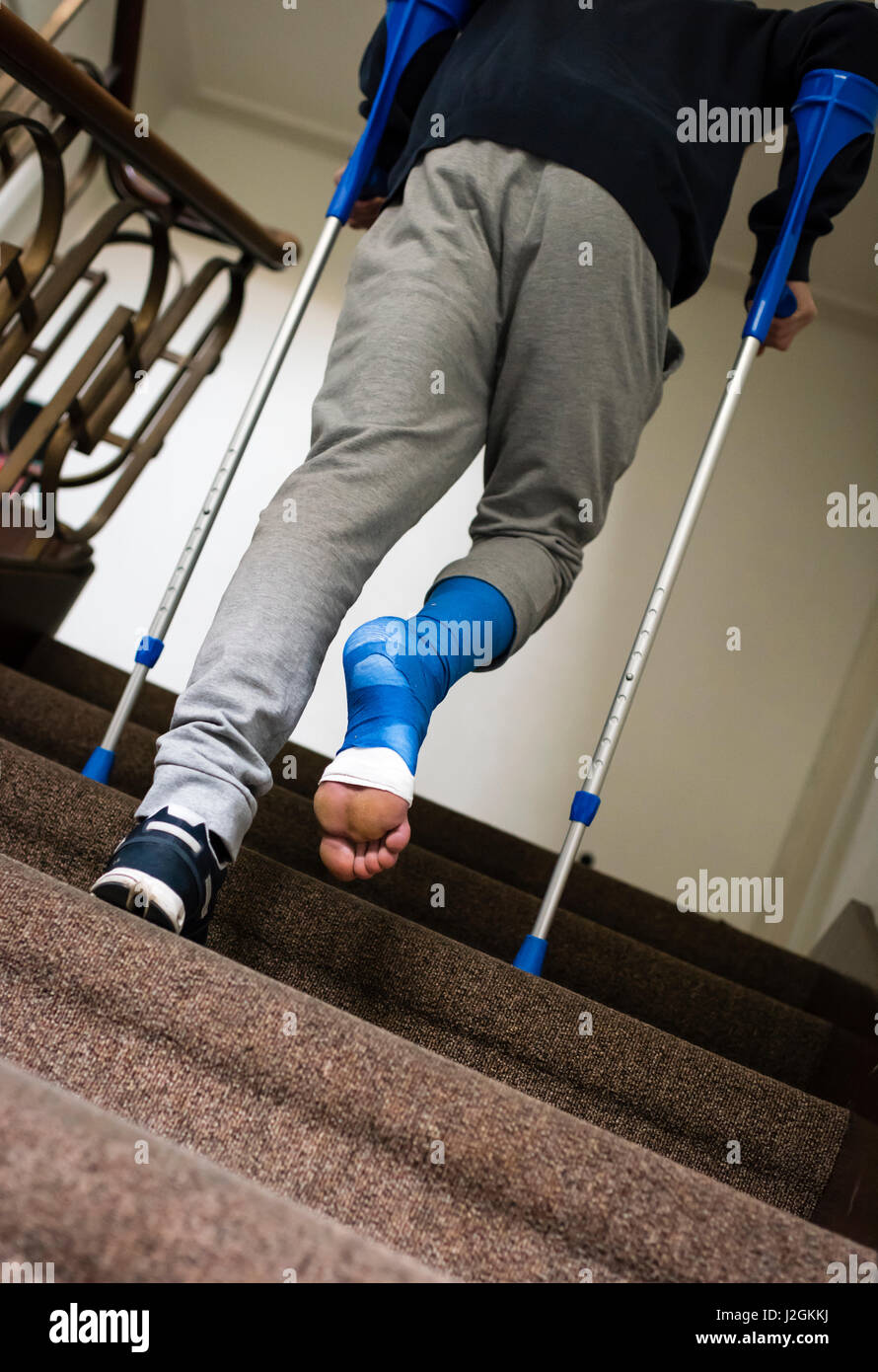 A young adult with crutches and his foot bandaged in plaster is ascending steps of a stairway inside an apartment house. Barefoot toes are sticking ou Stock Photo