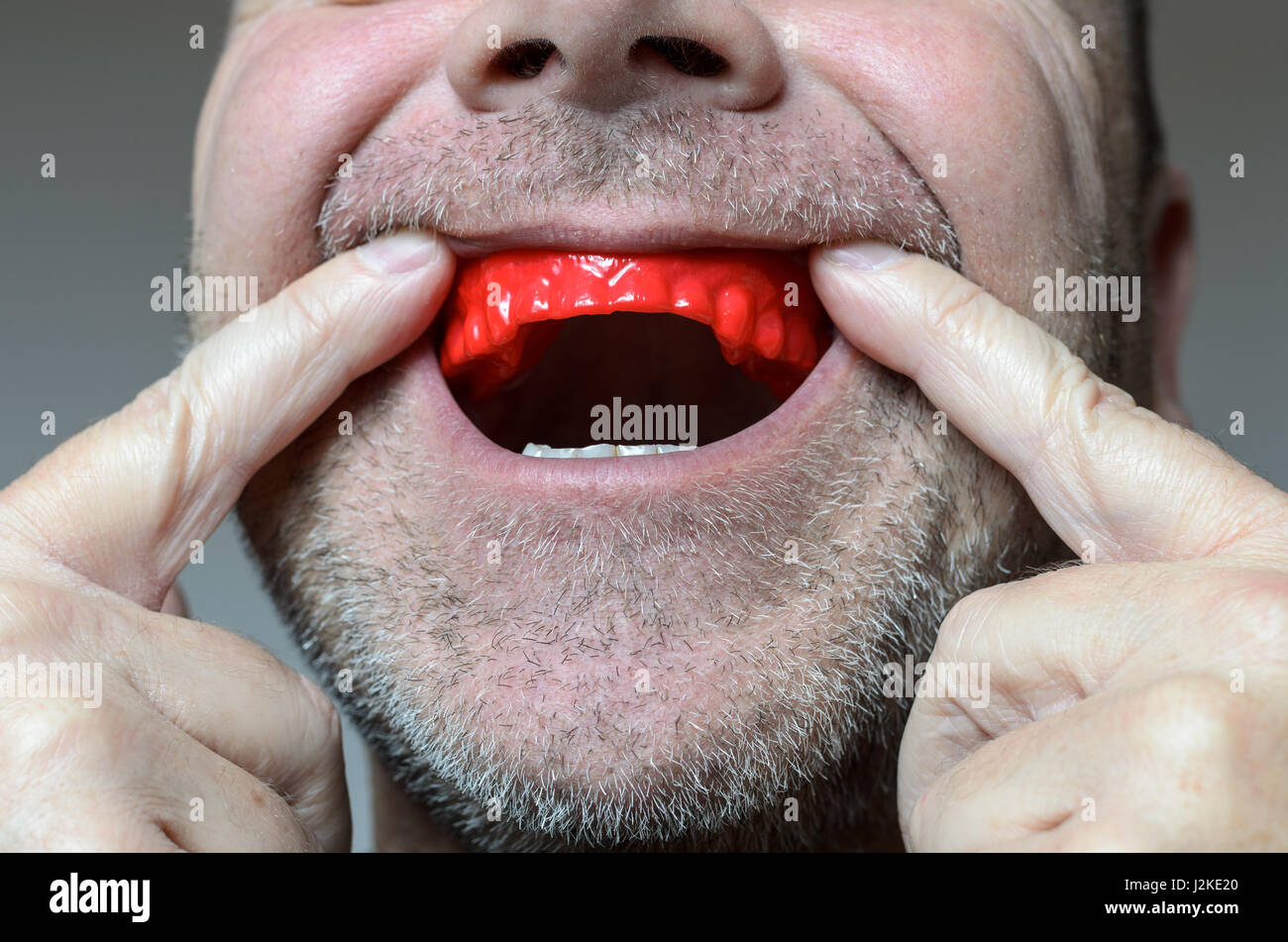 Man placing a red bite plate in his mouth to protect his teeth at night