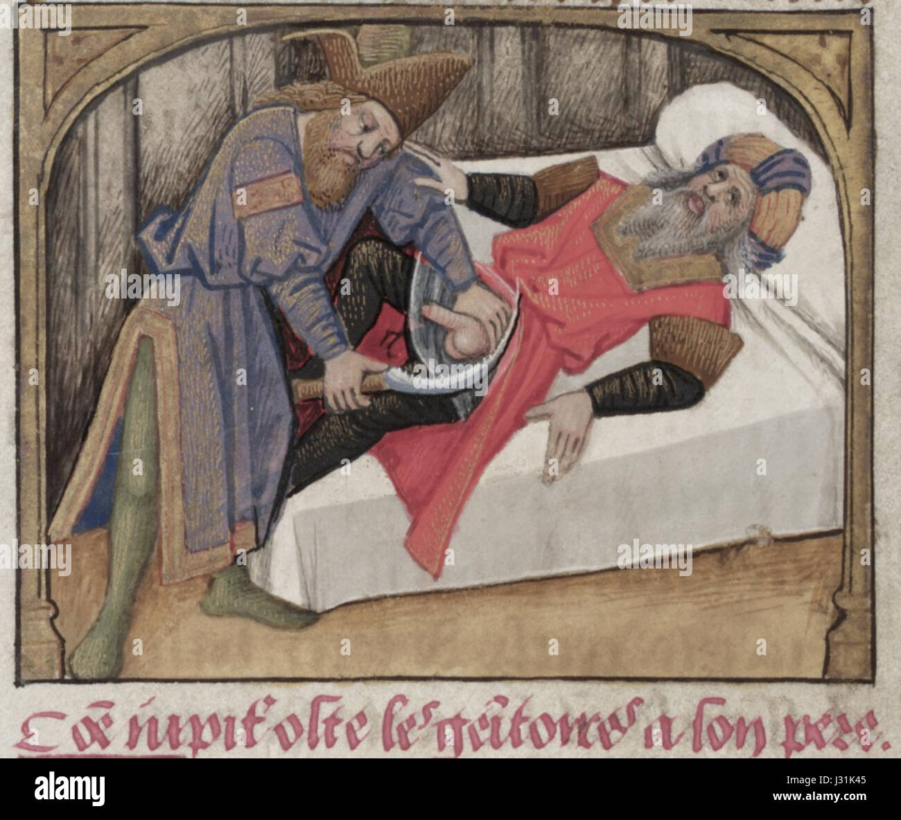 castration 