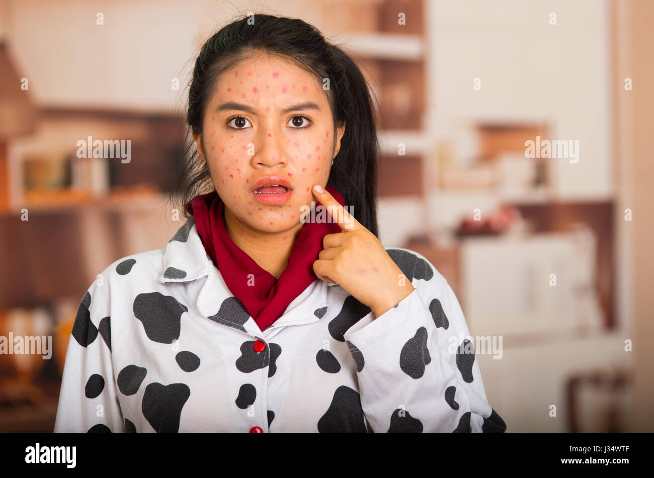 Portrait of young girl with skin problem got surprised Stock Photo