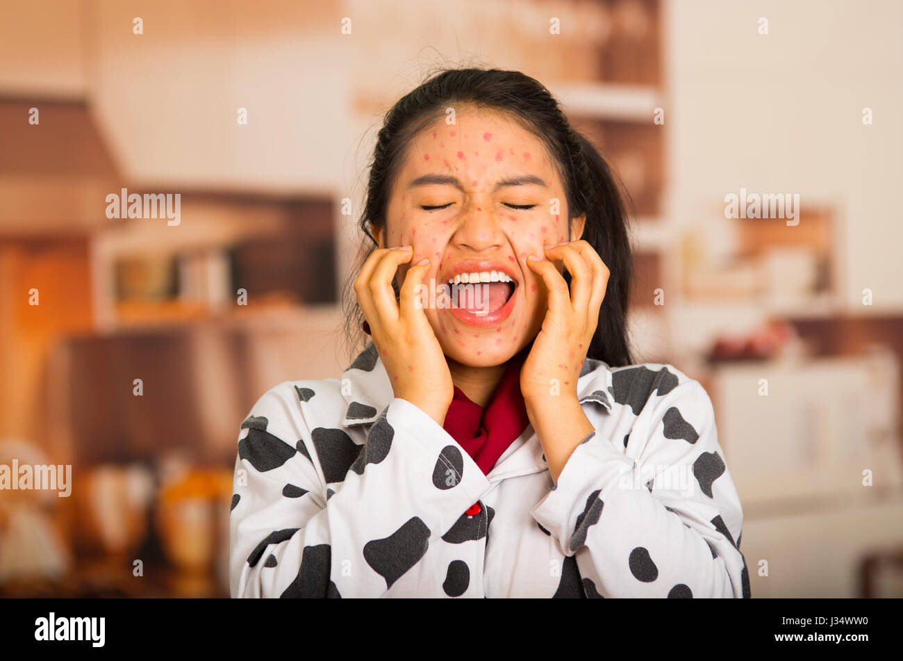 Portrait of young girl with skin problem scratch her face with both hands Stock Photo