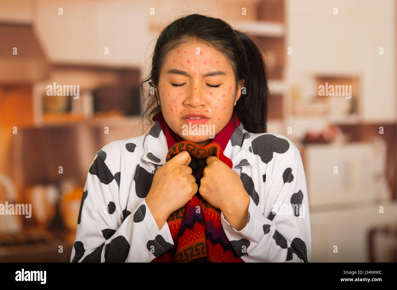 Portrait of young girl with skin problem with a red wool sweater around his neck Stock Photo