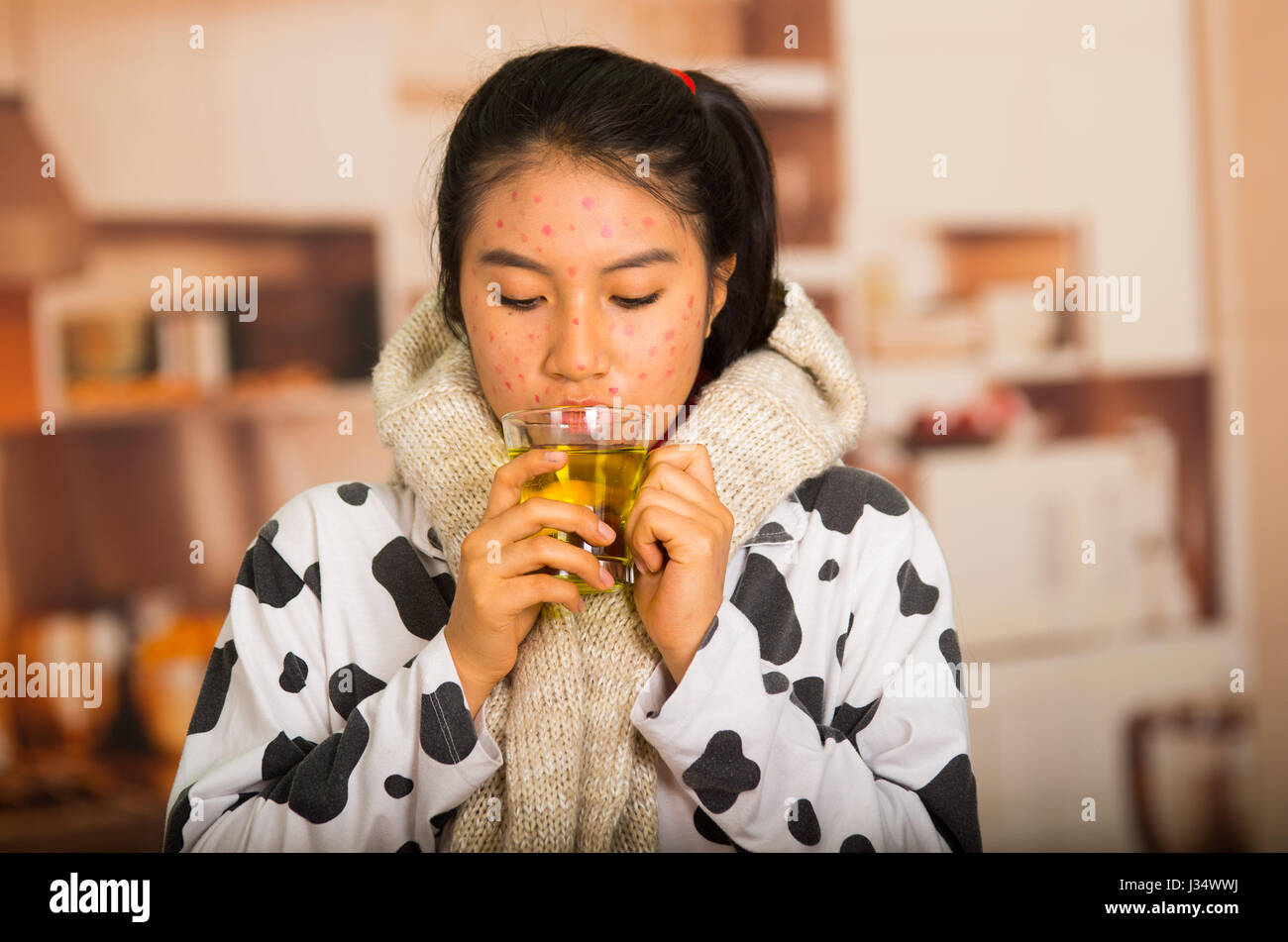Portrait of young girl with skin problem drinking a cup of te with a grey towel around her neck Stock Photo