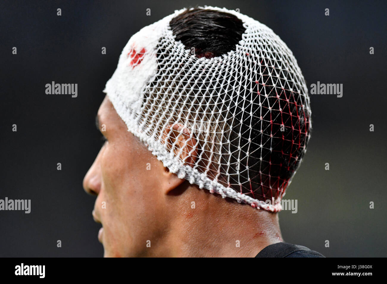 FC Internazionale soccer player Jeison Murillo with head injury at the san siro soccer stadium, in Milan. Stock Photo