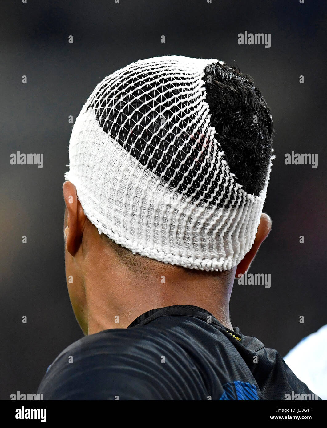FC Internazionale soccer player Jeison Murillo with head injury at the san siro soccer stadium, in Milan. Stock Photo