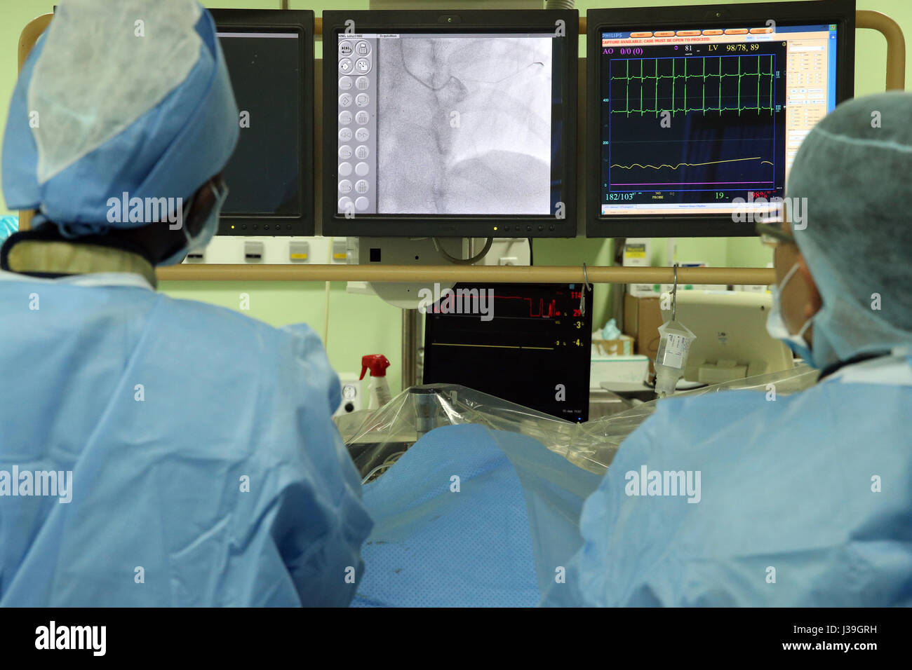 Cardiac catheter catheterization High Resolution Stock Photography and