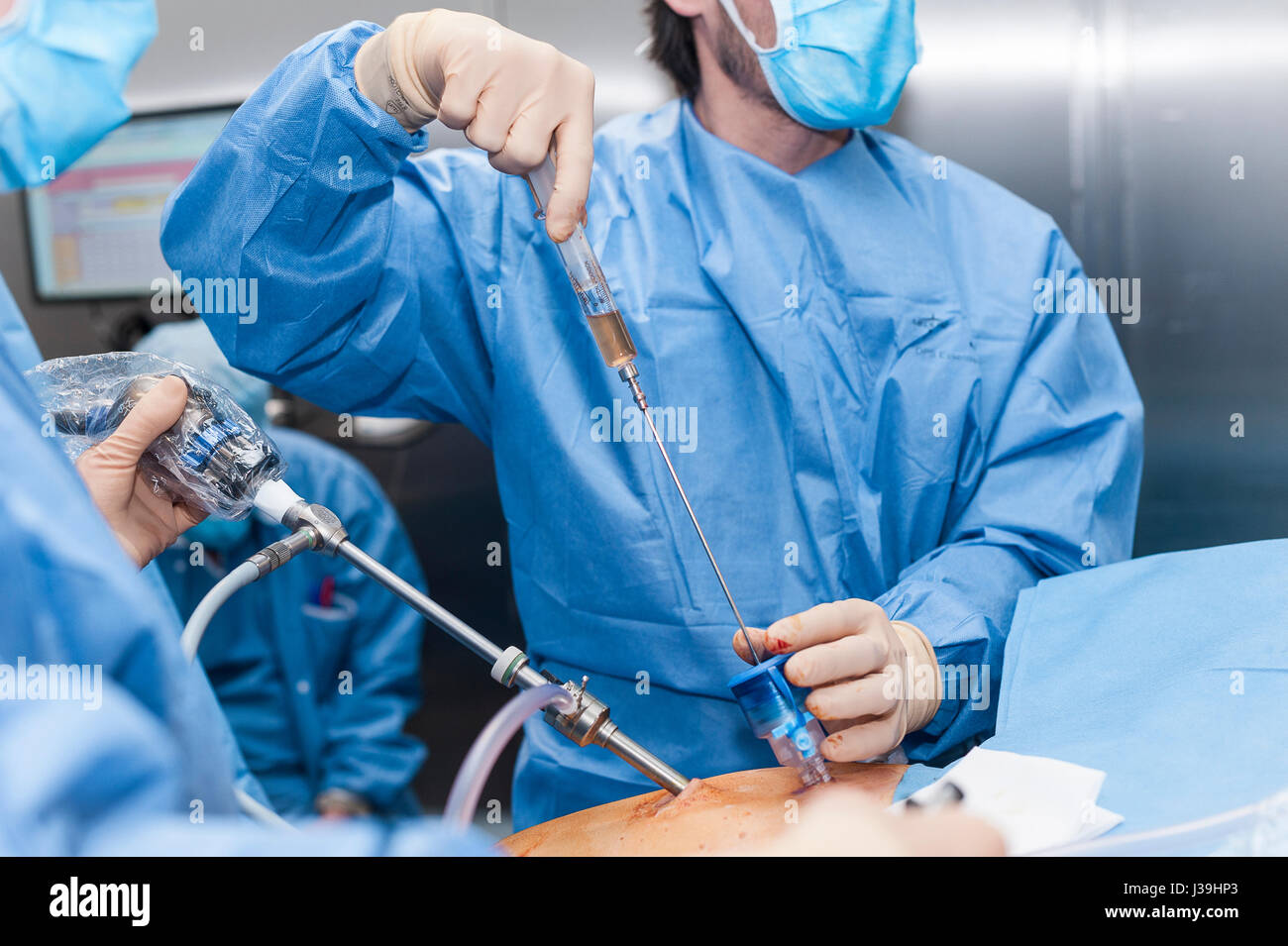 GYNECOLOGICAL SURGERY Stock Photo