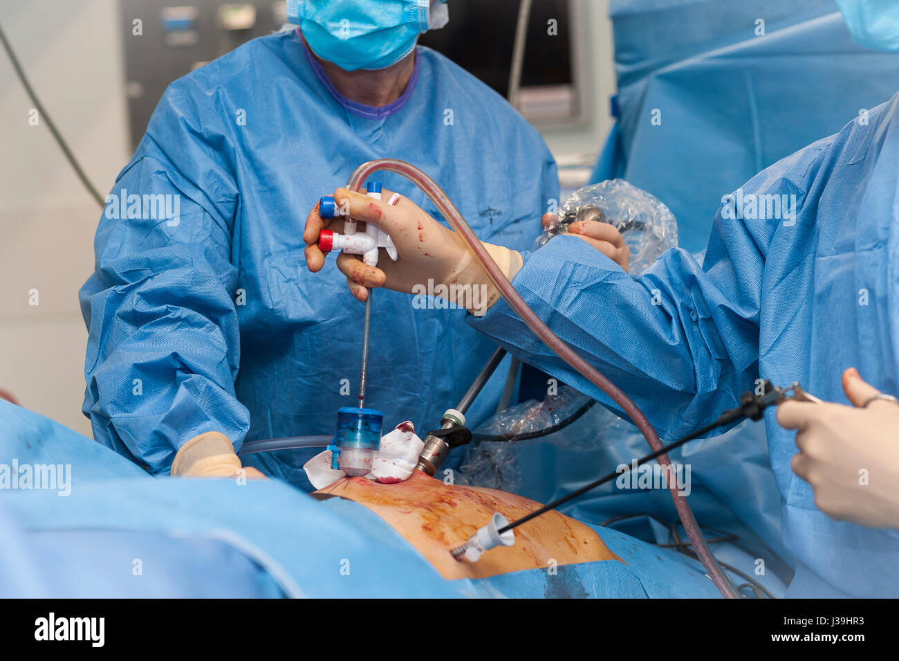 GYNECOLOGICAL SURGERY Stock Photo