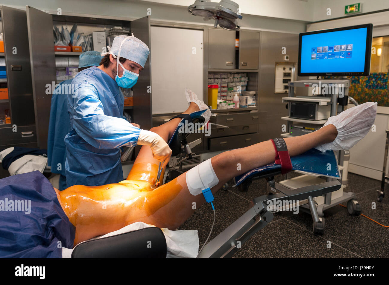 GYNECOLOGICAL SURGERY Stock Photo