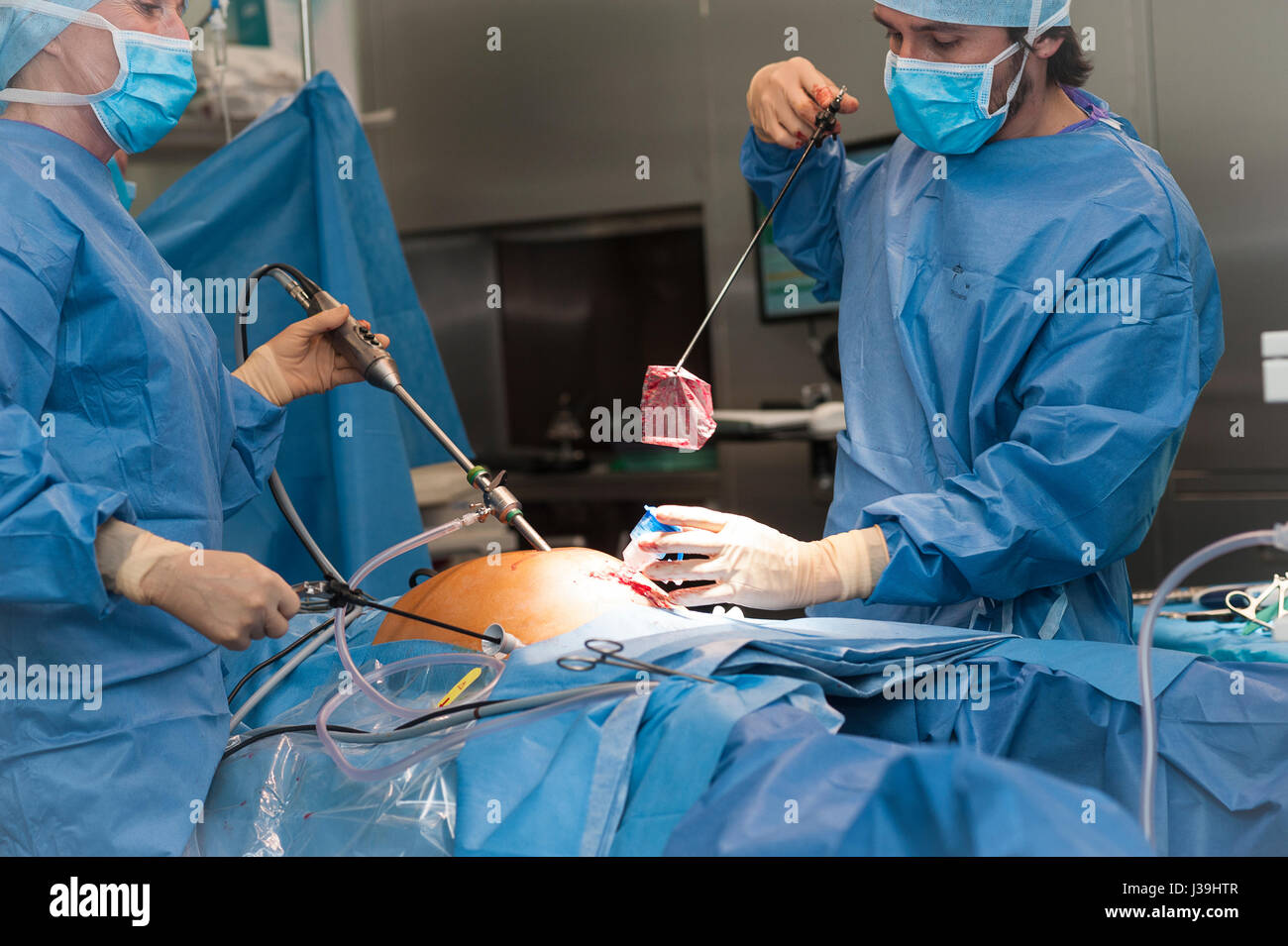 GYNECOLOGICAL SURGERY Stock Photo