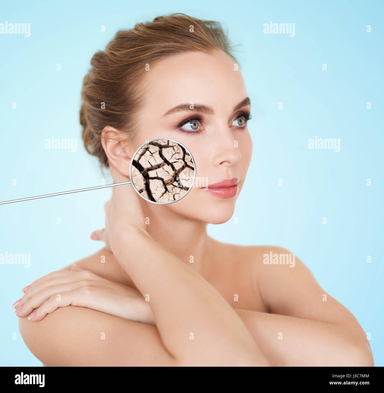 woman face with dehydrated cracked dry skin Stock Photo Alamy