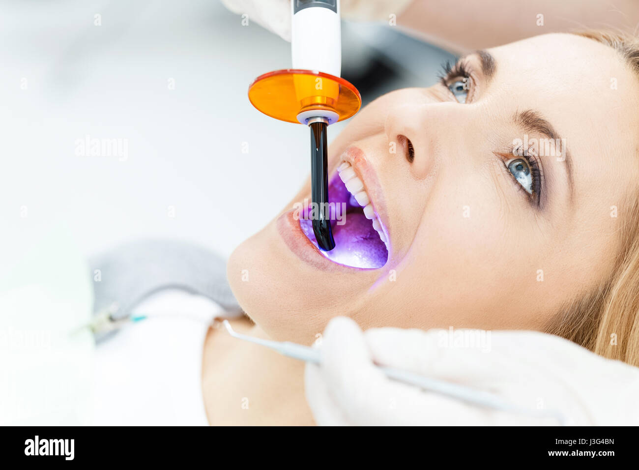 Dental uv hires stock photography and images Alamy