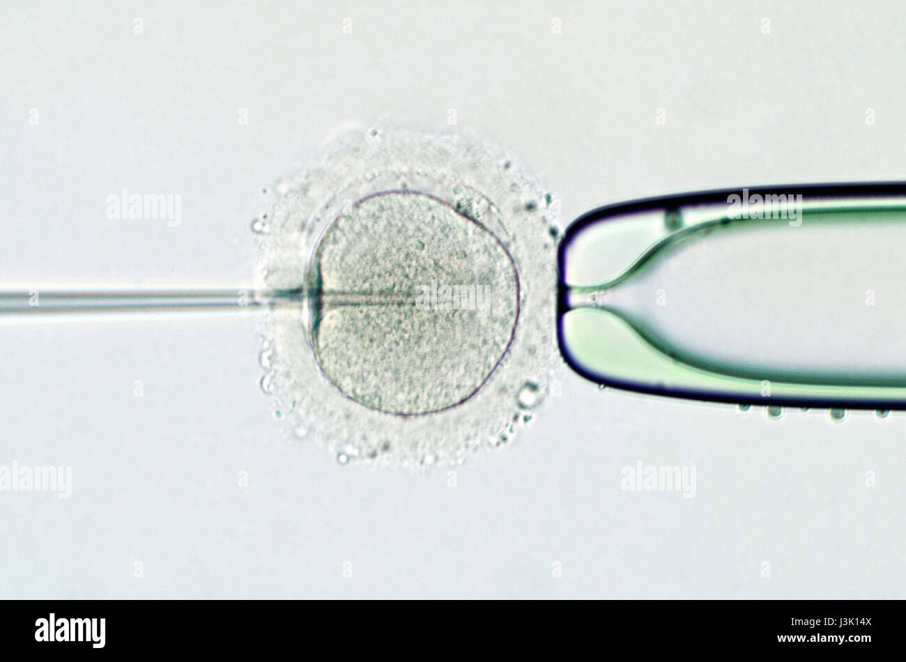 an artificial insemination by intracytoplasmic sperm injection Stock