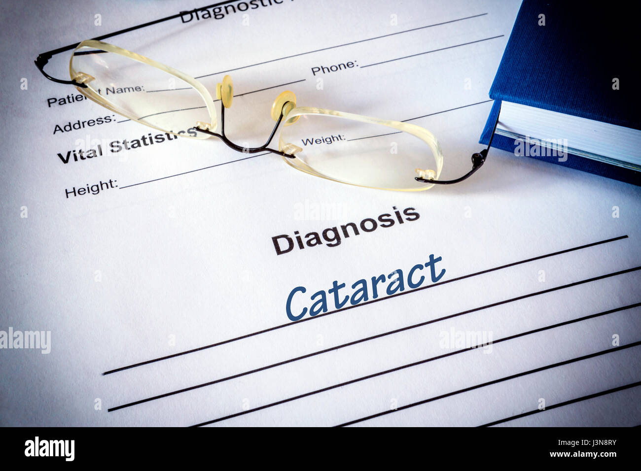 Diagnosis list with cataratc. Eye disorder concept. Stock Photo