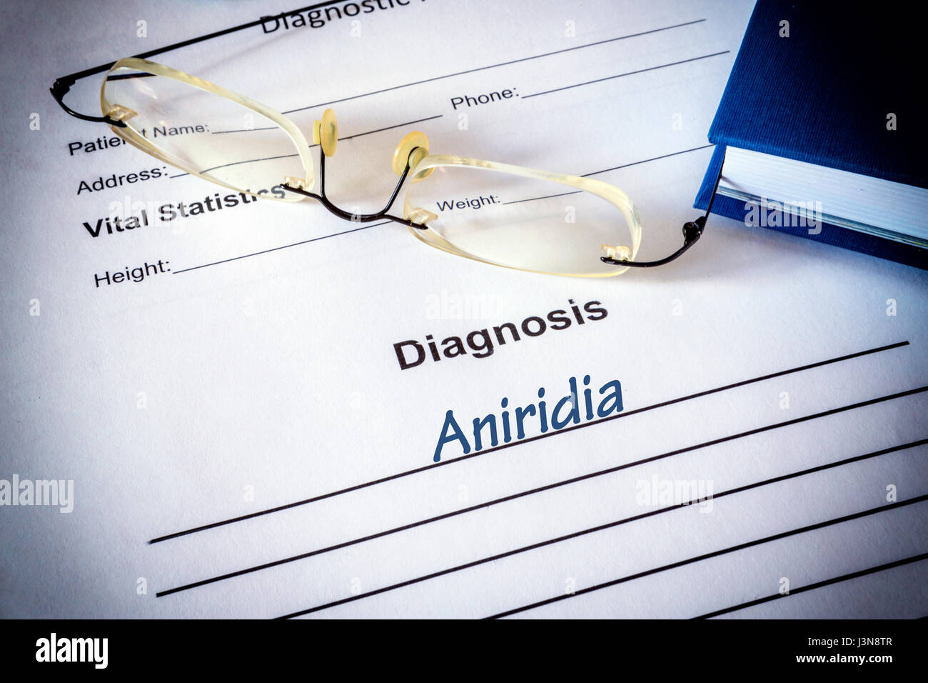 Diagnosis list with aniridia. Eye disorder concept. Stock Photo