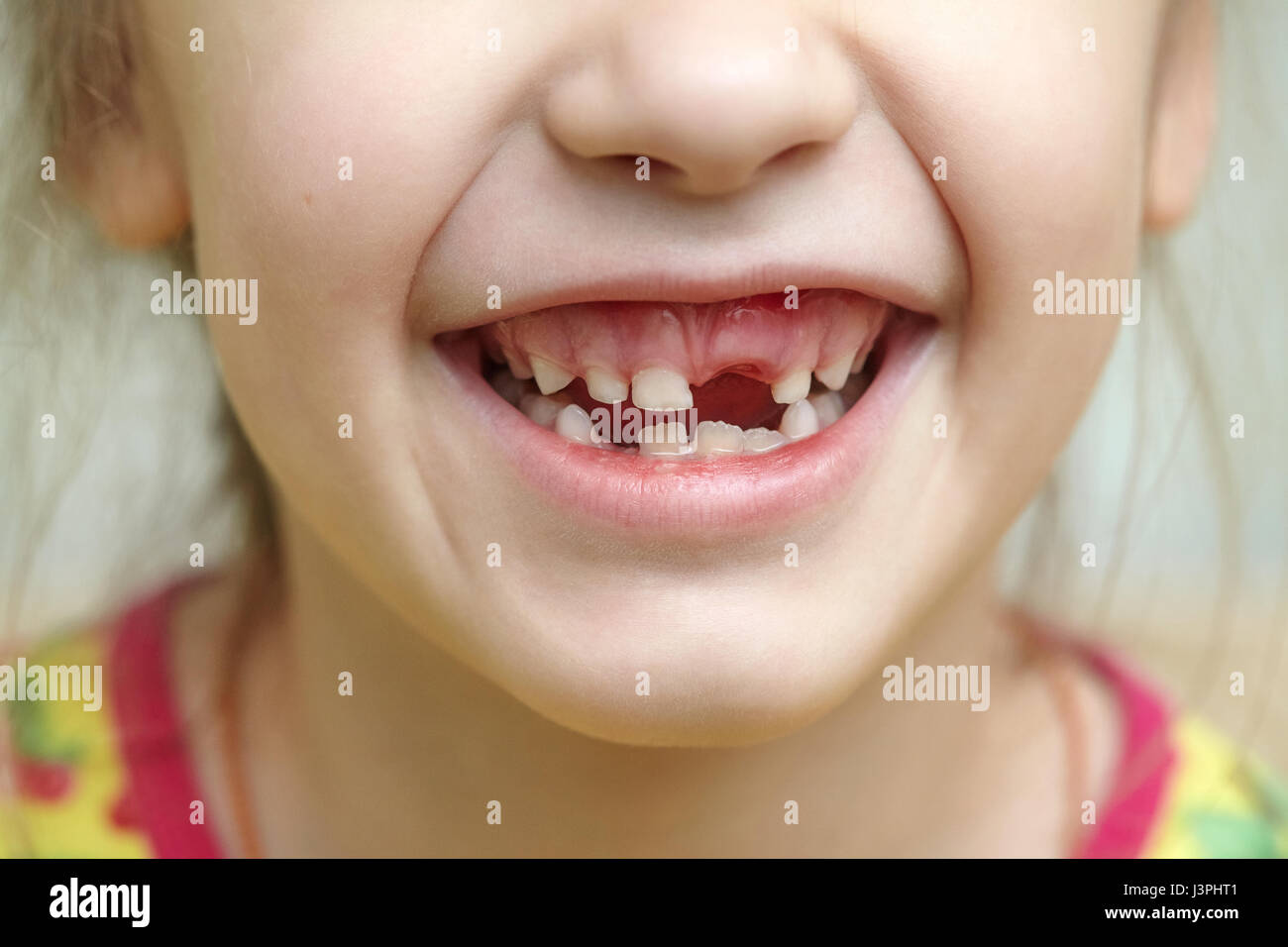 Ребенок без молочных зубов. Беззубая детская улыбка.