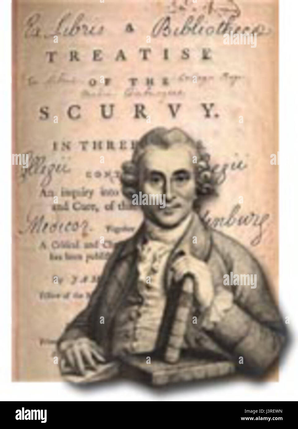 James Lind, a Scottish physician, is best known for his pioneering work in treating scurvy. In 1747, he conducted one of the first controlled experiments, demonstrating that citrus fruits could prevent the disease, marking a milestone in medical history. Stock Photo