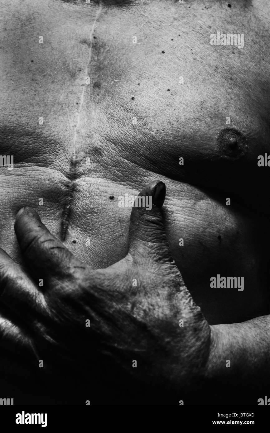 Think, Appendicitis in adult Think, Appendicitis in adult something
