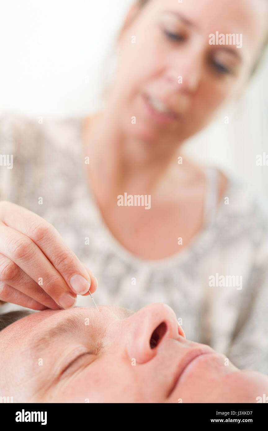 Acupuncturist inserting acupuncture needles into patient's skin Stock Photo