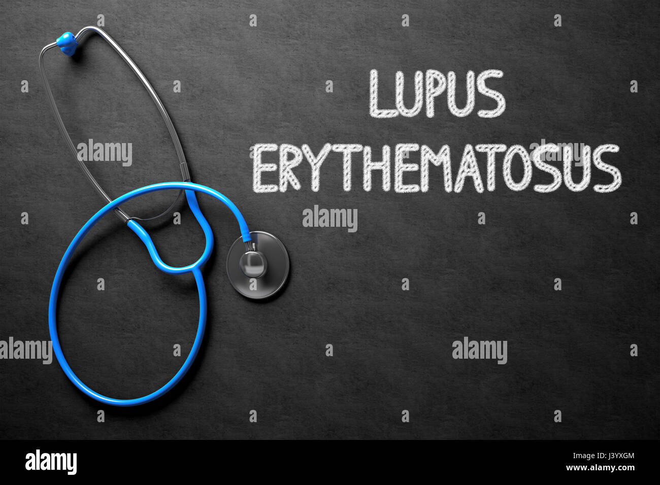 Lupus Erythematosus on Chalkboard. 3D Illustration. Stock Photo