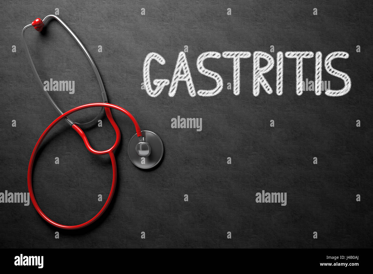Gastritis - Text on Chalkboard. 3D Illustration. Stock Photo