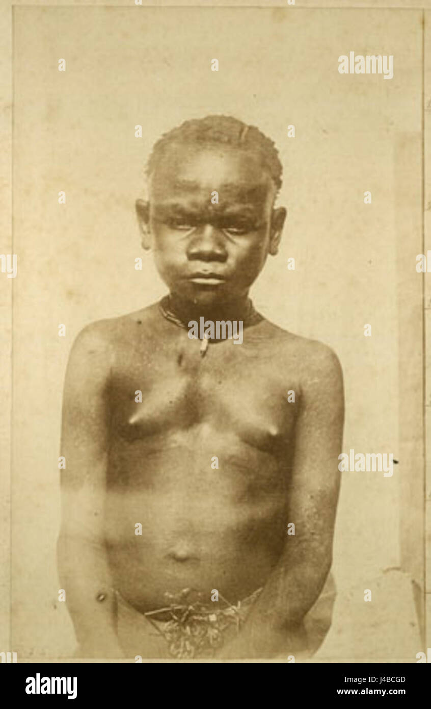 The portrait 'Baka Girl II' by Richard Buchta depicts an individual ...