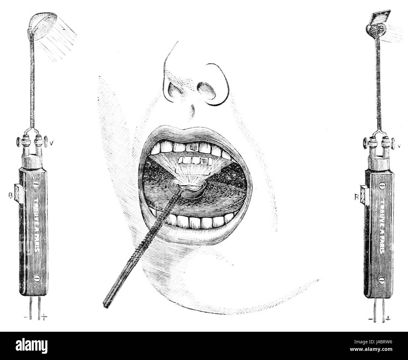 Vintage dental instruments hires stock photography and images Alamy