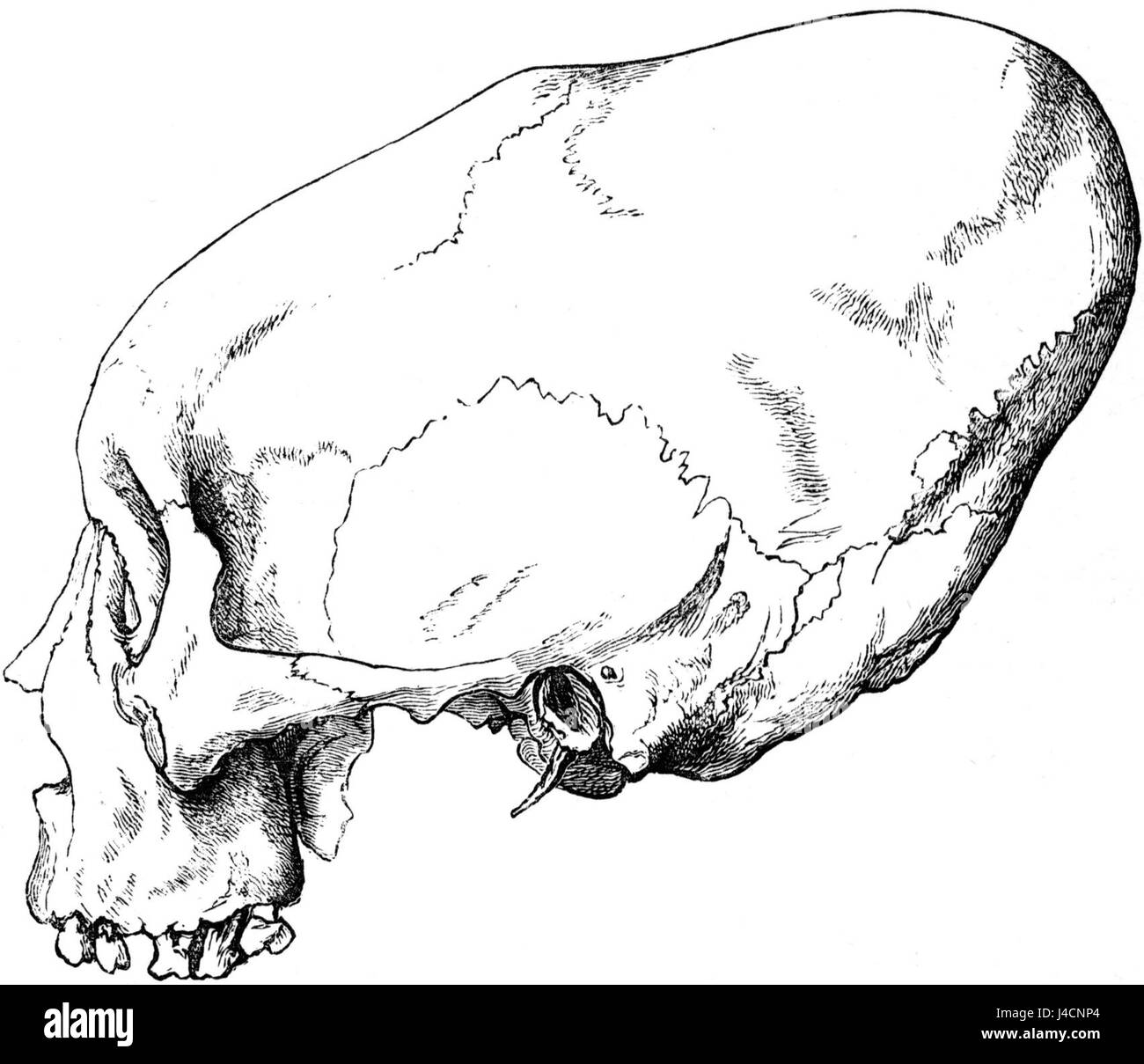 This image shows the cranium of a Koskeemo Indian, illustrating the physical characteristics and anthropology of indigenous people in North America. It provides an insight into their physical anthropology and cultural history. Stock Photo