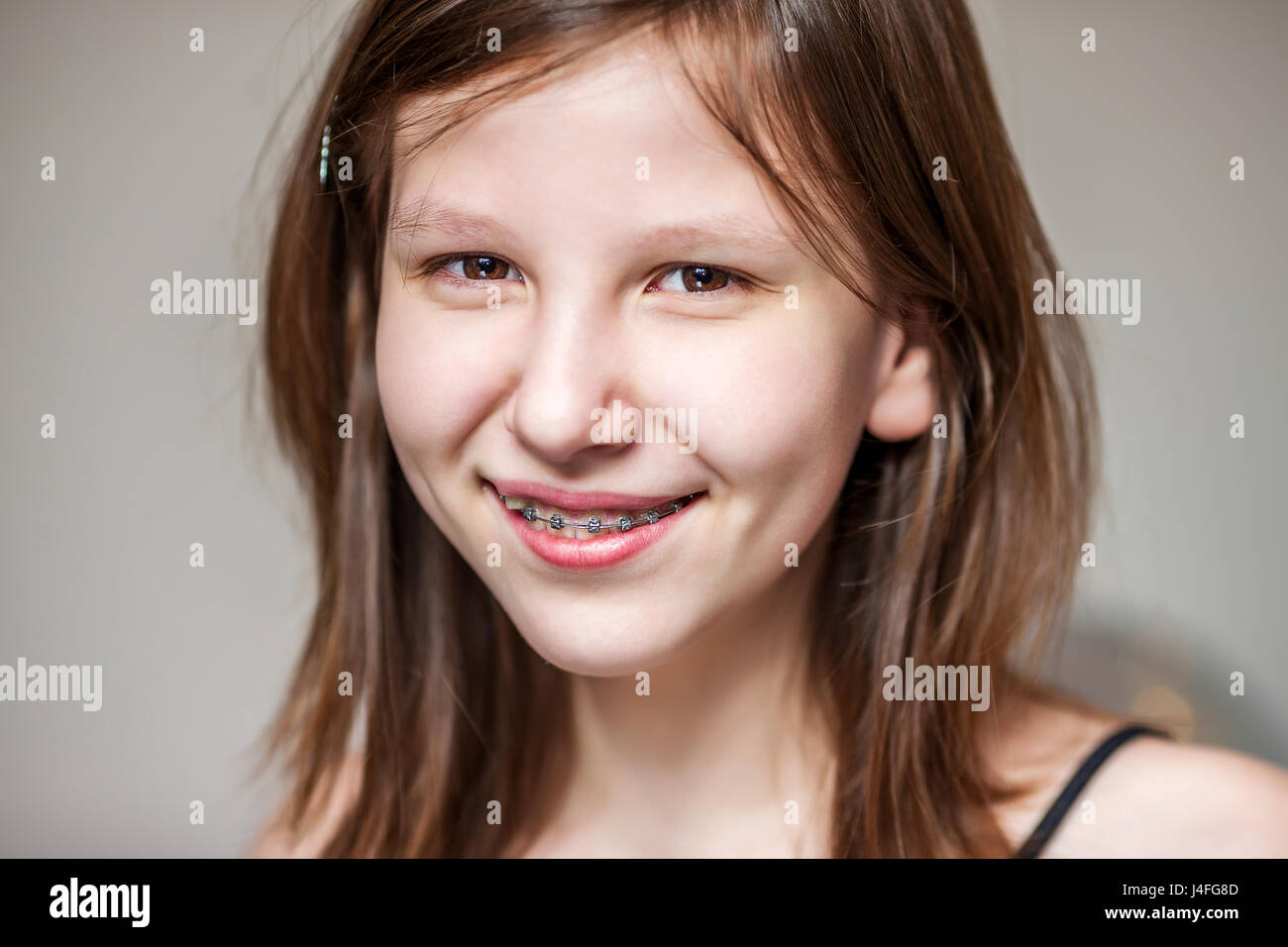Teen girl with braces hi-res stock photography and images - Alamy