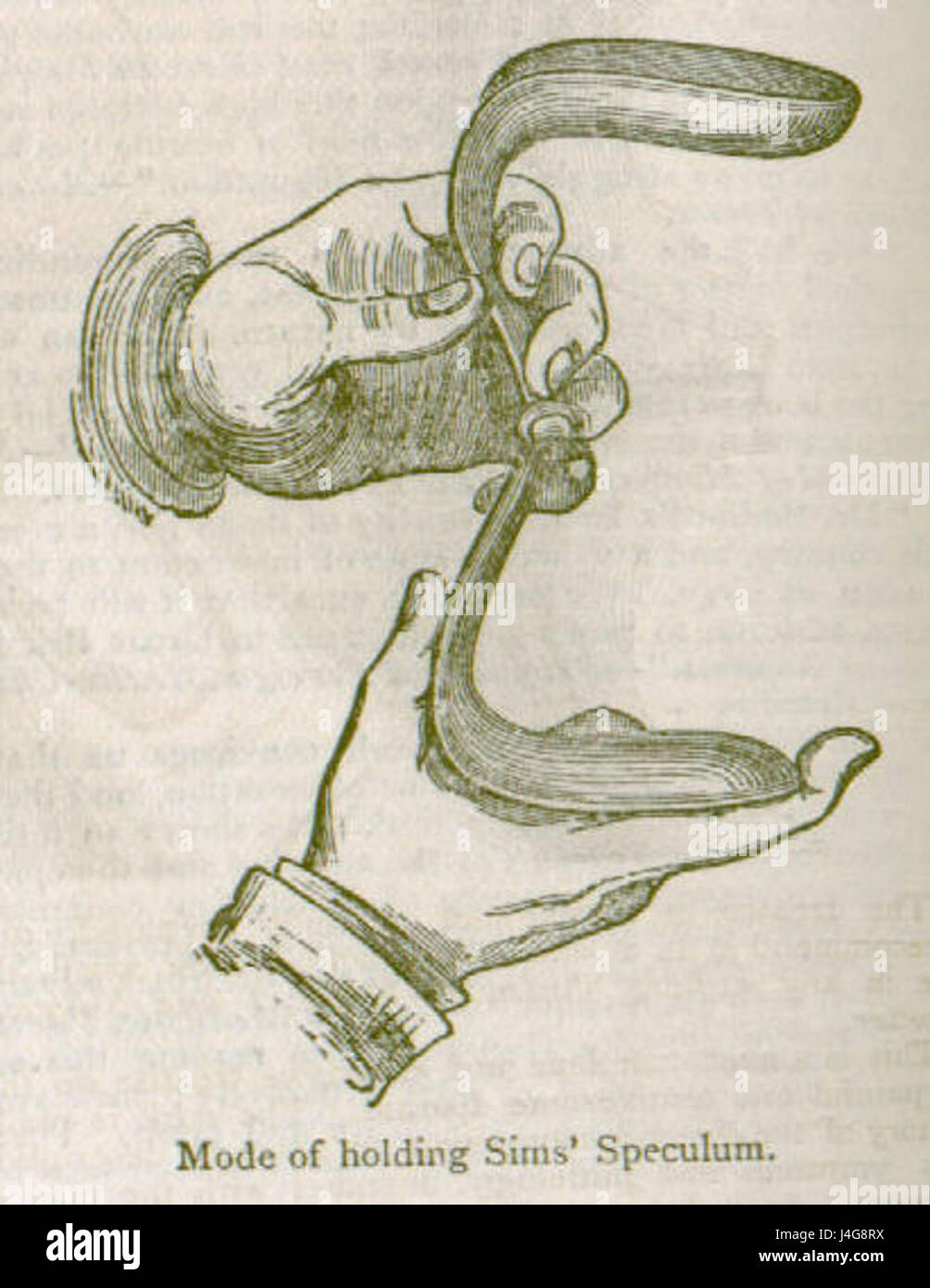 Sims speculum hires stock photography and images Alamy