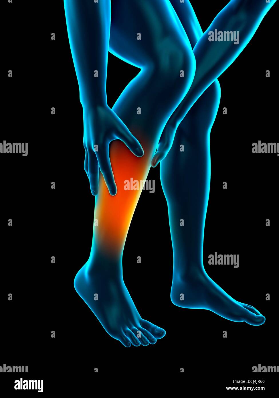 Human calf pain, illustration Stock Photo Alamy