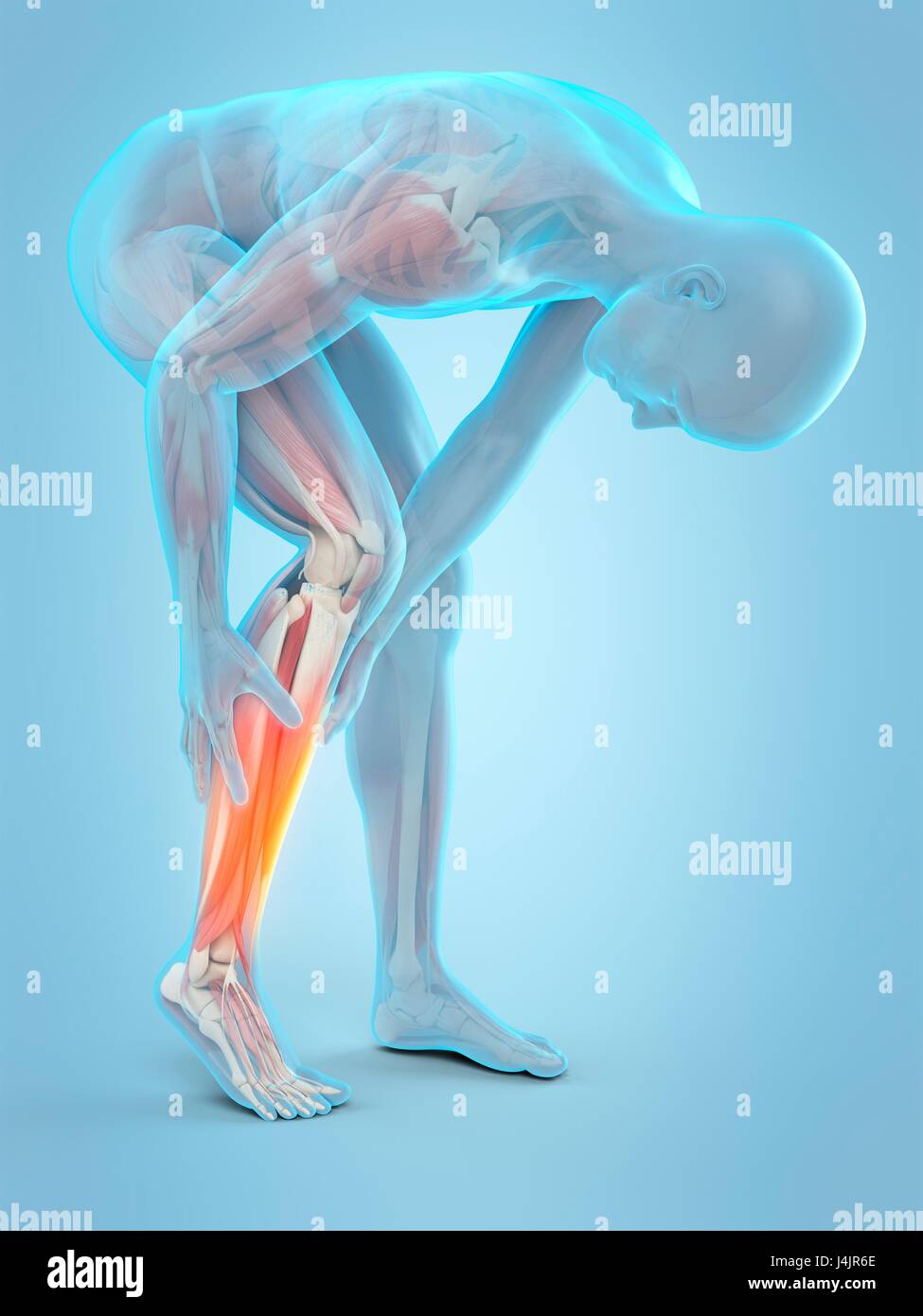 Human calf pain, illustration. Stock Photo