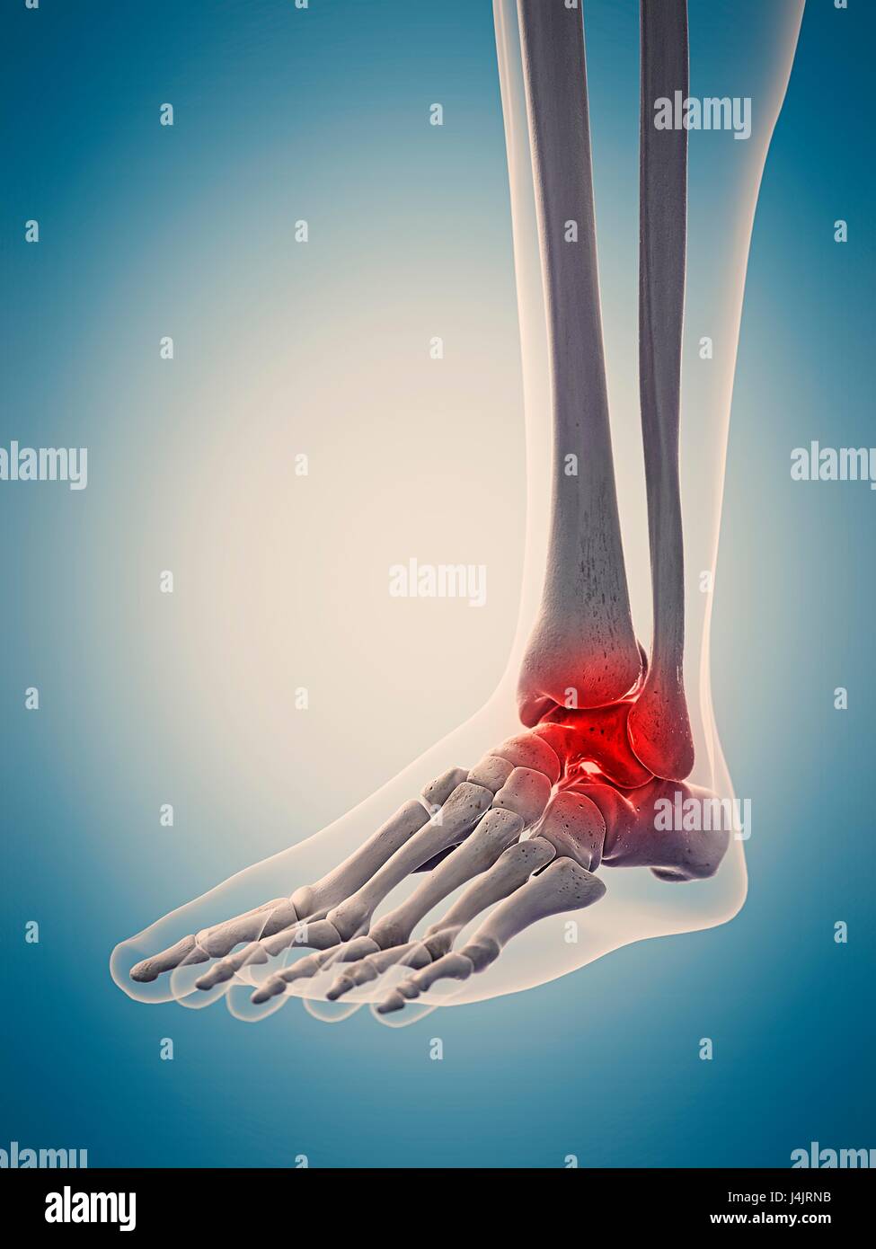 Human ankle pain, illustration Stock Photo - Alamy