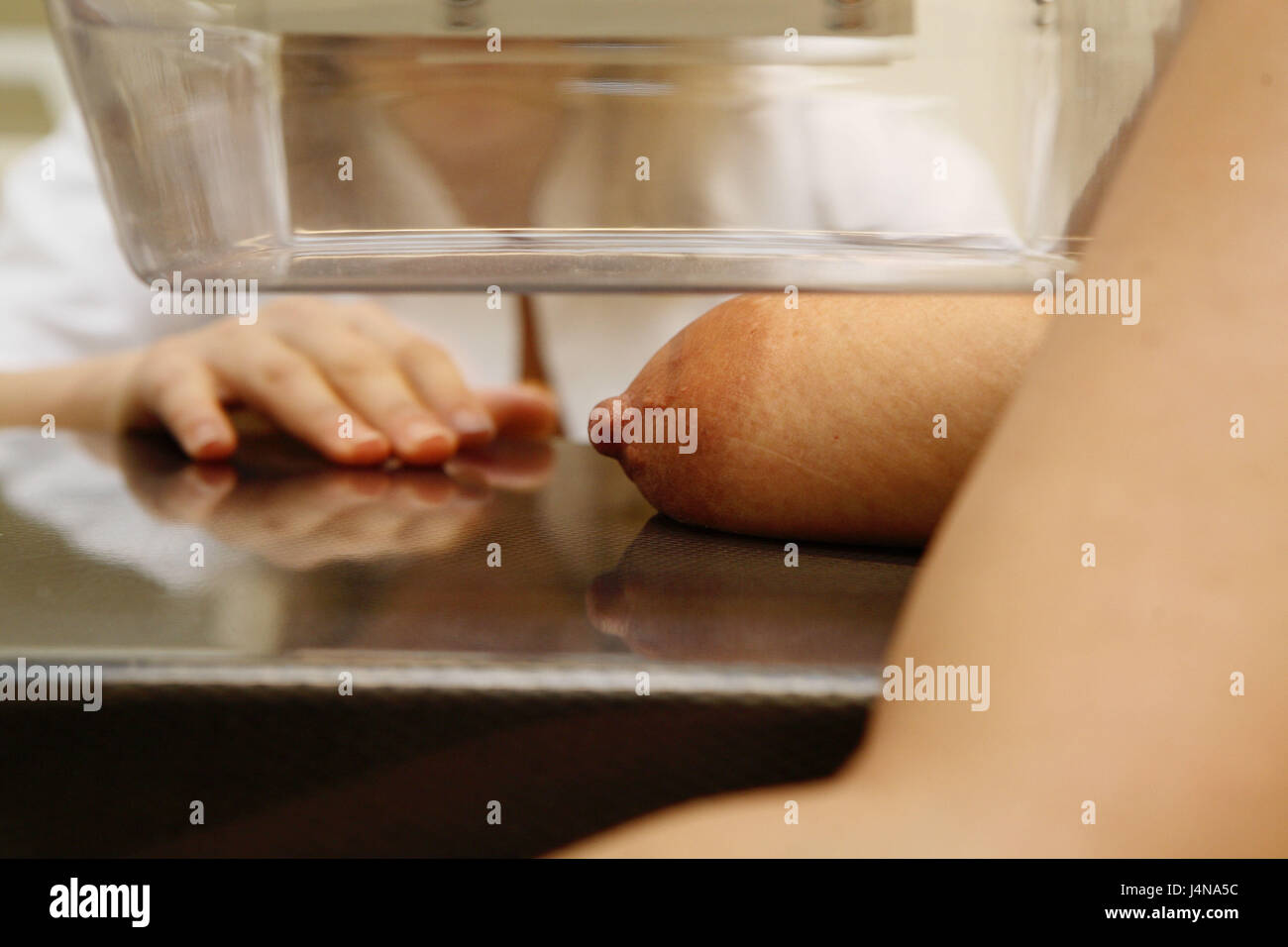 Mammography, breast, at the side, detail, Stock Photo