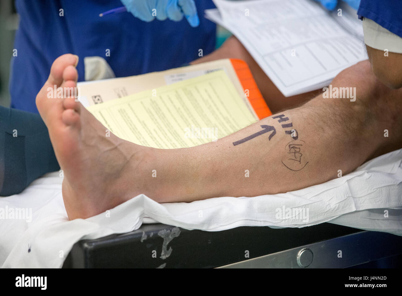 Patient is prepared for a hip operation on the left hip. The left leg