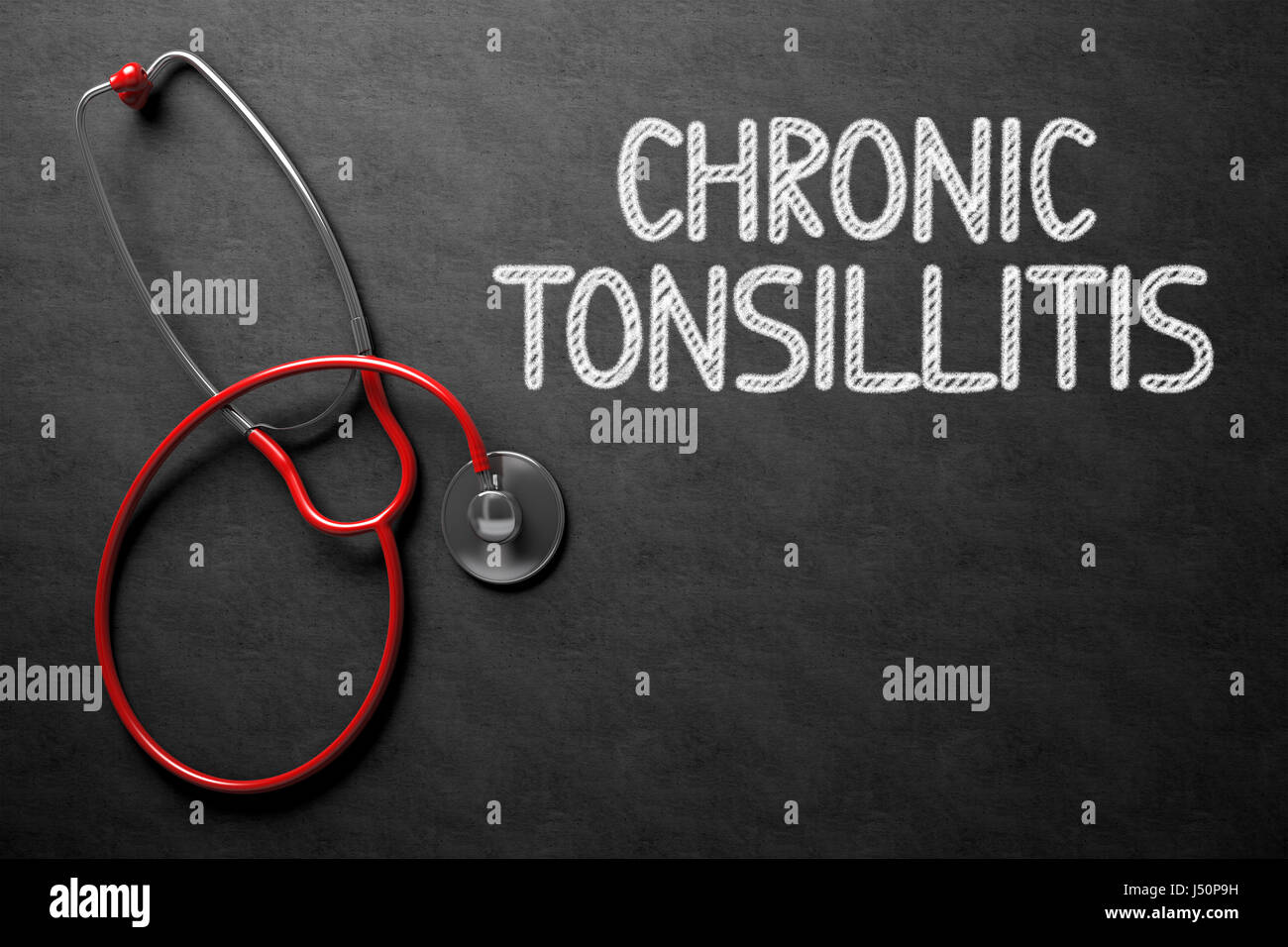 Chronic Tonsillitis - Text on Chalkboard. 3D Illustration. Stock Photo