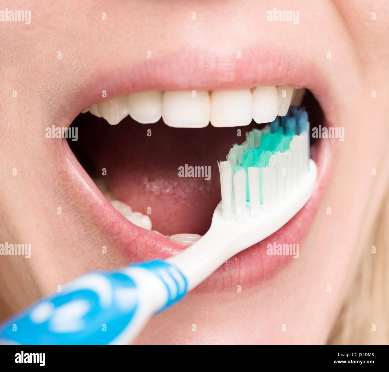 bleaching beautiful teeth Stock Photo