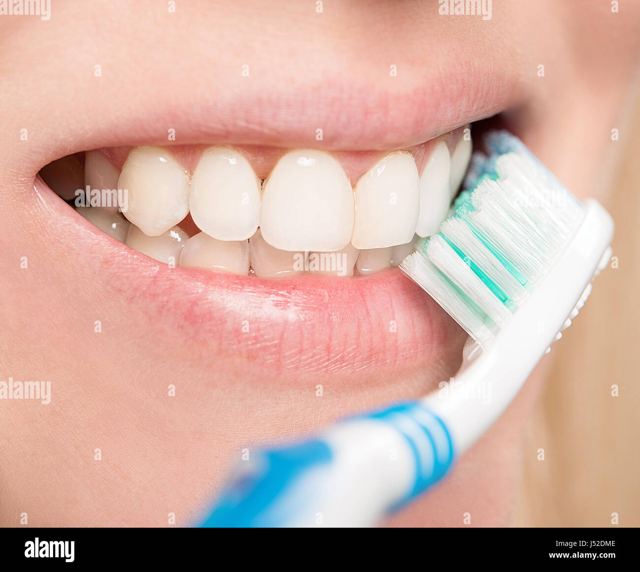 bleaching straight beautiful teeth Stock Photo