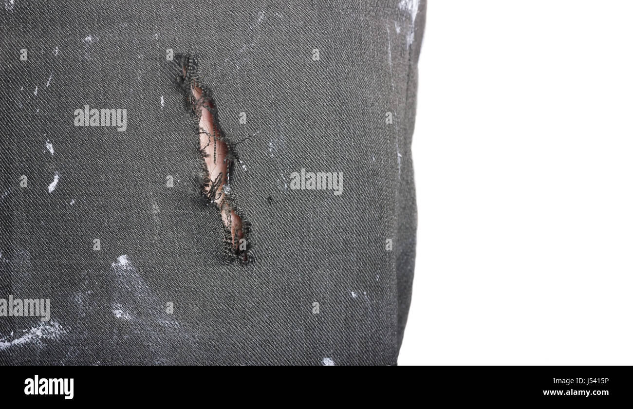 hole in the trousers of a worker with skin of leg hair in front isolated white background Stock Photo