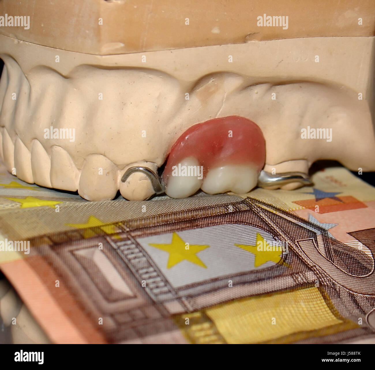 sickness fund bit dentist euro tooth crown bite dentures denture eating
