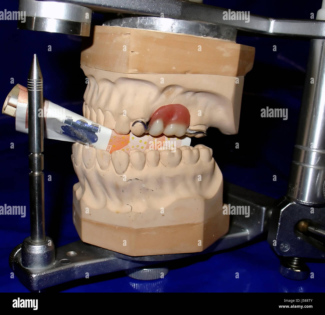 bit dentist tooth crown bite dentures gold tooth denture eating eat