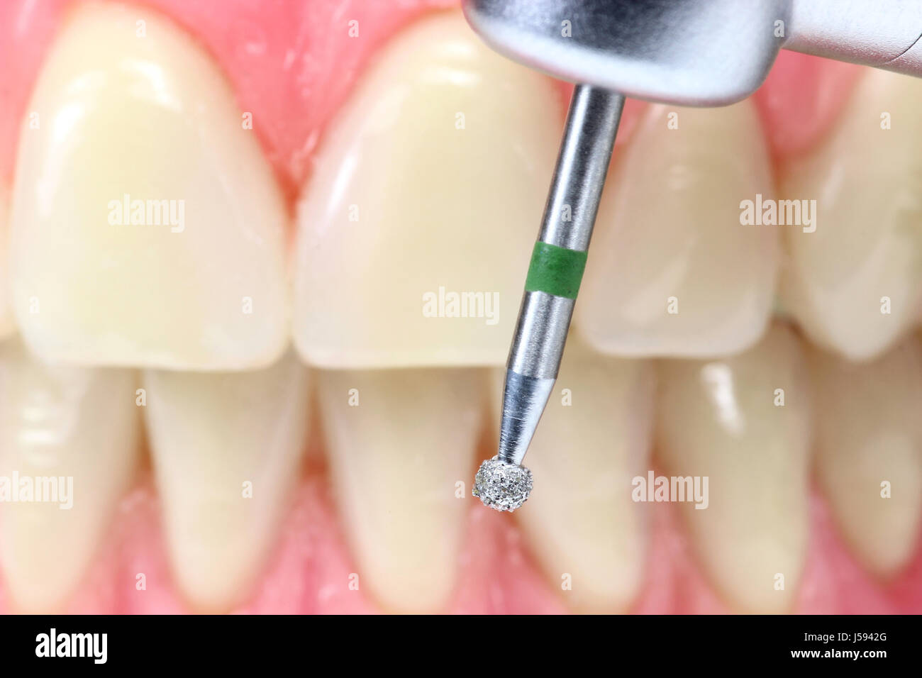 dental drill and tooth model Stock Photo Alamy