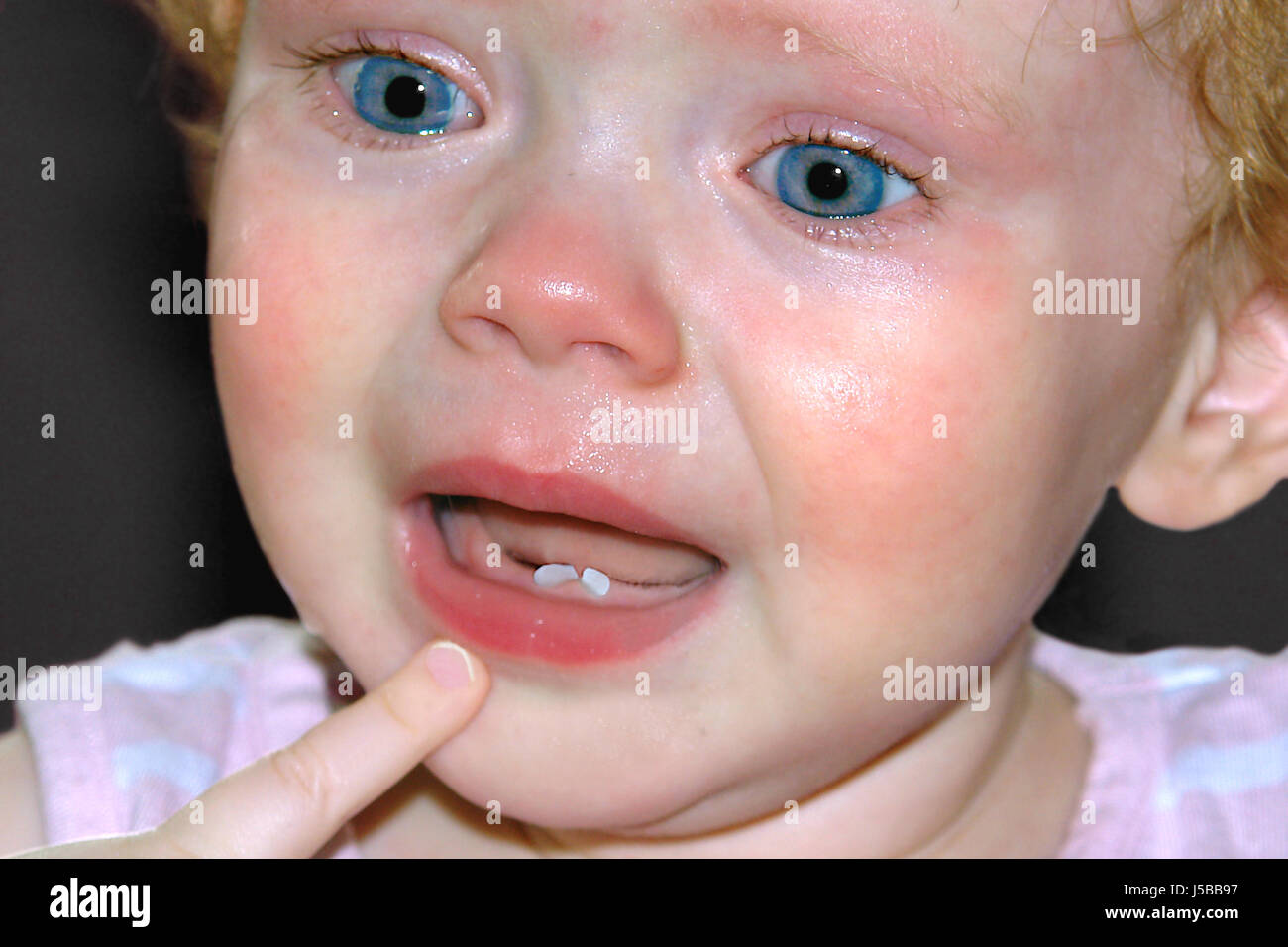 Milk teeth incisors hires stock photography and images Alamy
