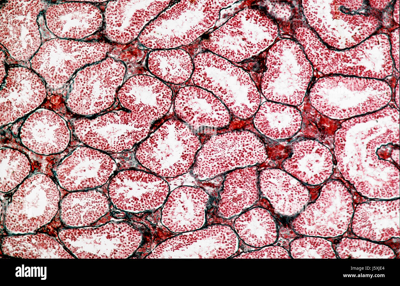 testicular human,microscopic Stock Photo