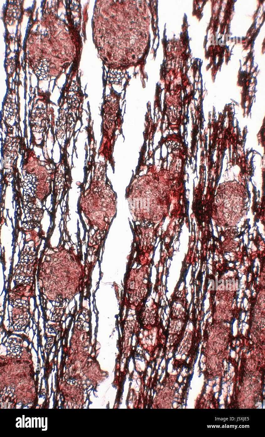 wood zerstoerender fungus microscopic Stock Photo